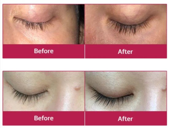 Miracle Lash Result
