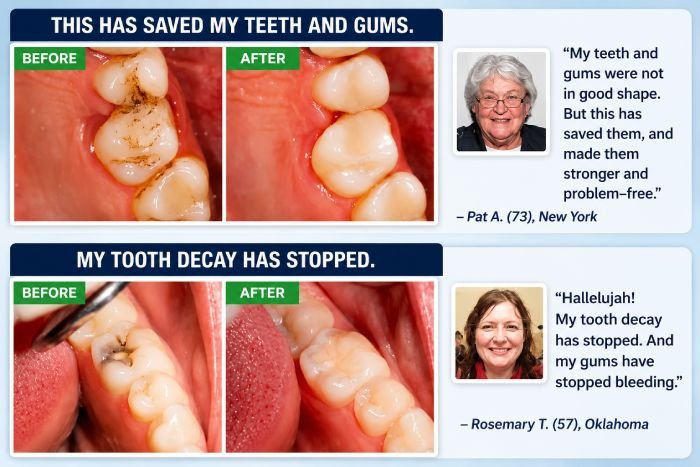 ProXental Customer Reviews